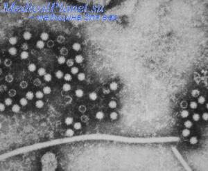 Хронический гепатит у детей – вопросы диагностики и лечения